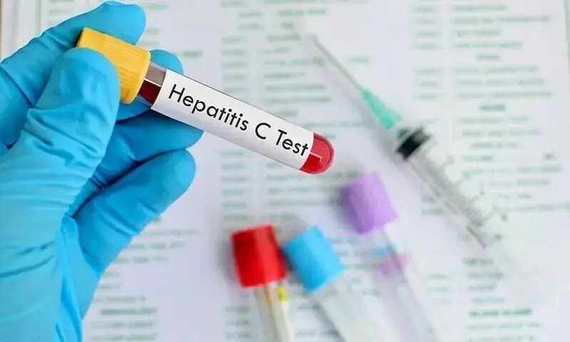 Six HIV, 13 Hepatitis C cases detected among prisoners at Pakpattan jail