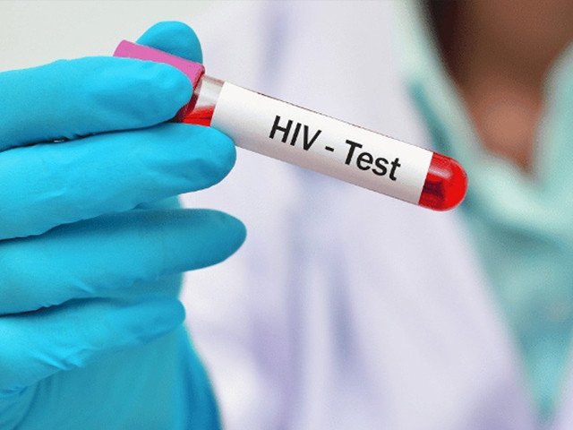 Task force plans HIV spread survey