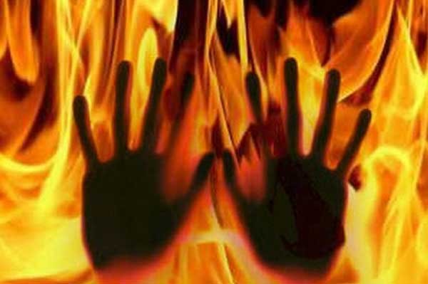 سسرالیوں کے ہاتھوں جلائی گئی خاتون دم توڑ گئی